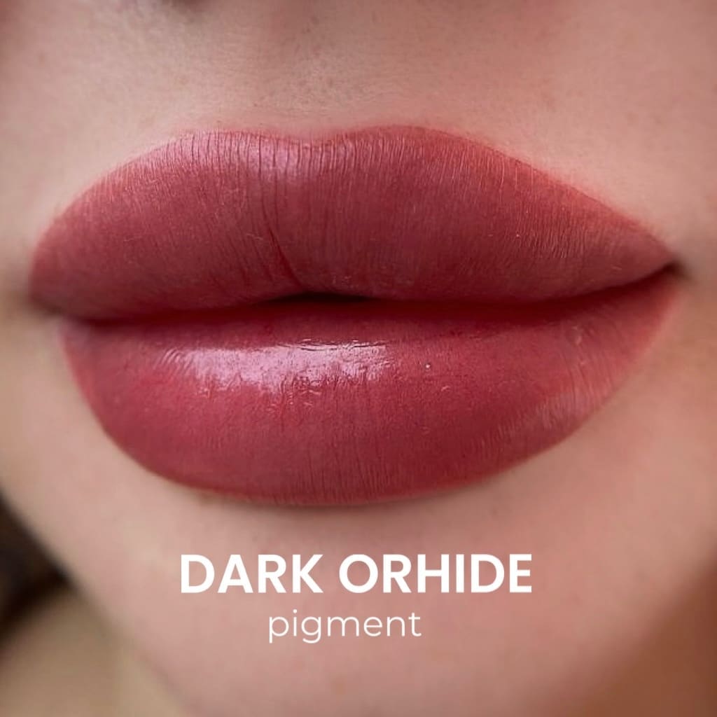 Orhide Set - Imagen 3